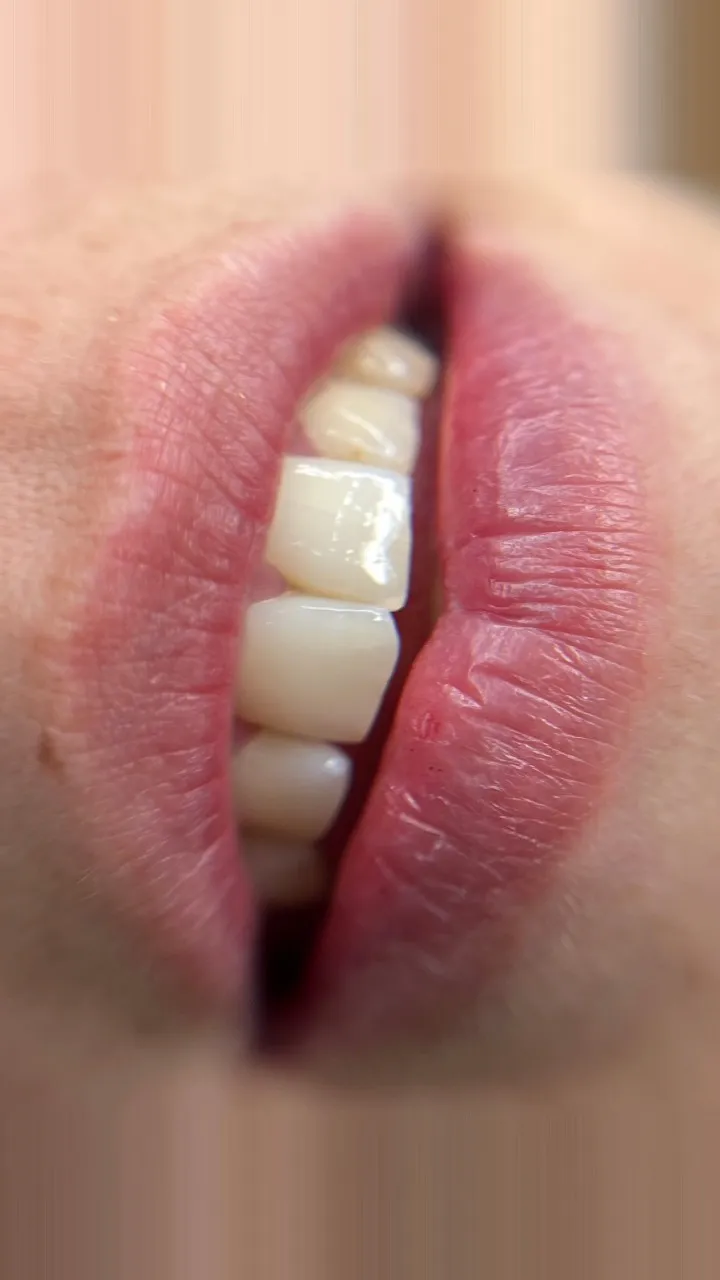 Labios antes de la micropigmentación