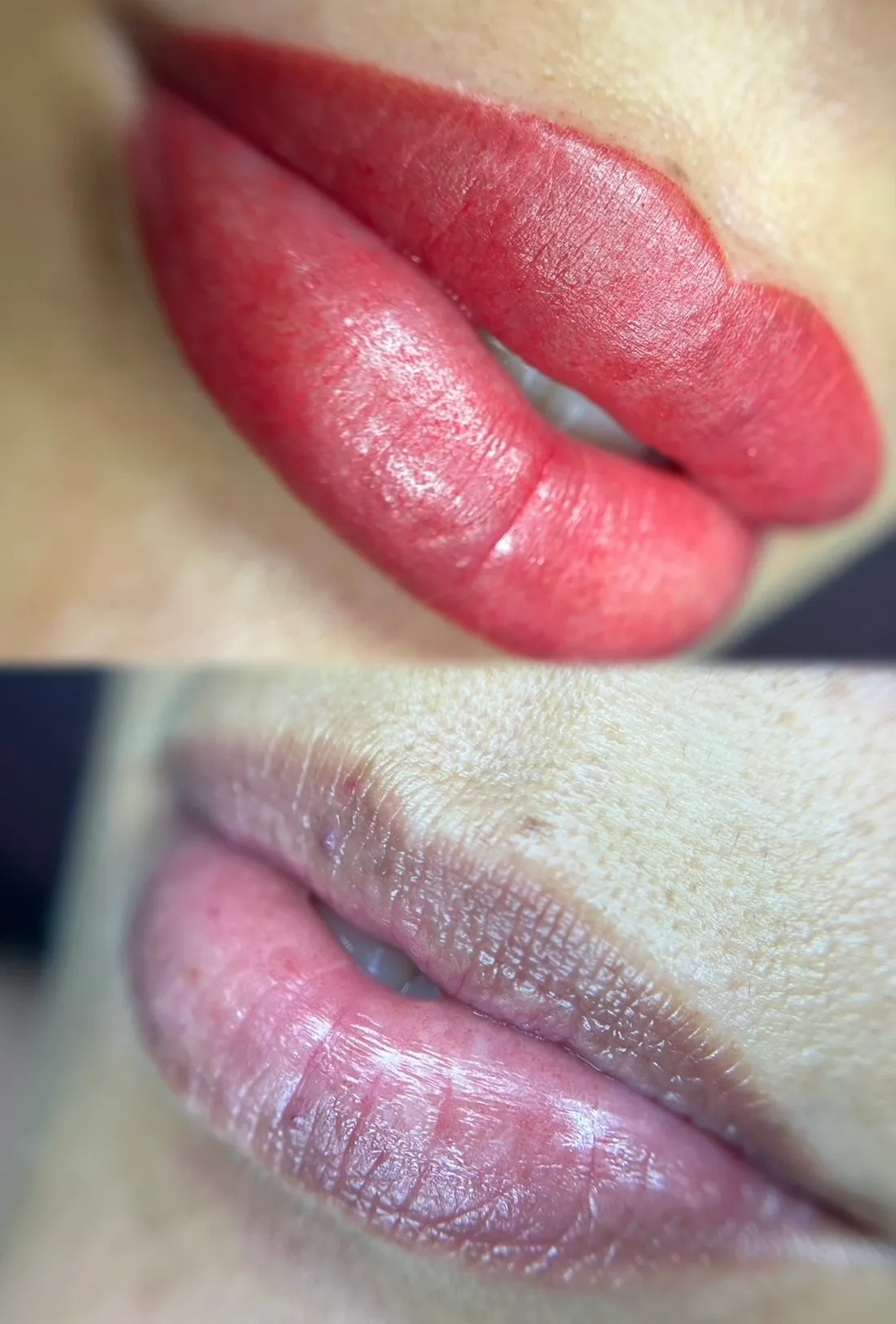 Antes y después de una neutralización de labios oscuros
